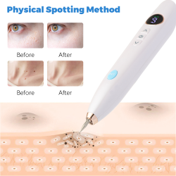 Laser Skin Tag Remover Face Mole Remove