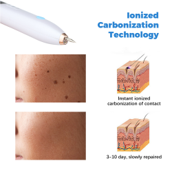 Laser Skin Tag Remover Face Mole Remove