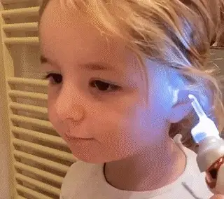 Tweddy Smart EarWax Remover
