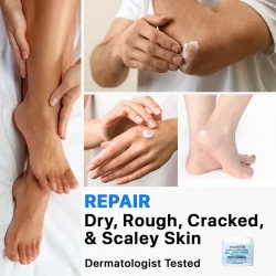 Foot Cream Calluses Removing Dead Skin Cleansing Cutin