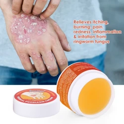 Dermatitis Eczemn Tinea Itching Silver Shavings And Antipruritic Skin care