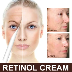 Retinol Cream, Anti-Aging Firming Brightening Moisturizing Facial Skin