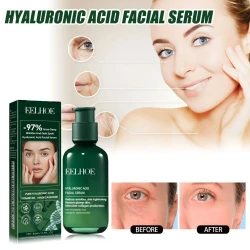 Facial Essence Lifts And Tightens Facial Skin