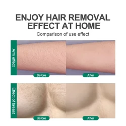 Crystal Hair Removal