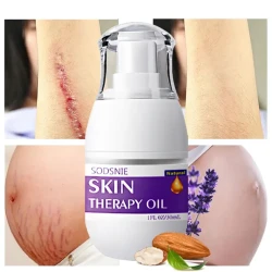 Treatment Oil Remove Puncture Cellulite Stretch Mark