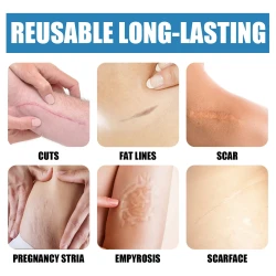 Light Scar Pen Gentle Fade Repair Skin Scar