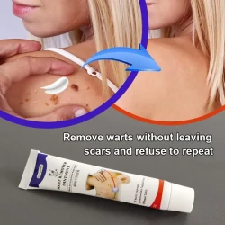 Wart Flat Monkey You Wart Removal Cream