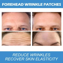 Forehead Wrinkle Patch Reduces Wrinkles,