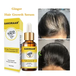 Ginger Hair Loss Products Natural With No Side Effects