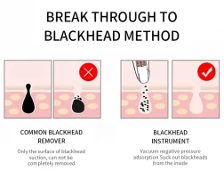 Electric suction head instrument