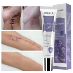 Advanced Scar Cream 20G