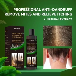 Itch Relief, Hair Loss Prevention, Oil Control & Refreshing Car