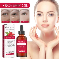 EELHOE Rosehip Facial Oil