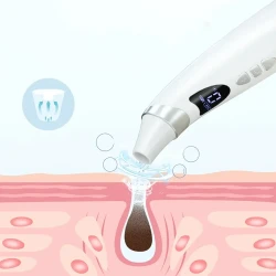 Visual Blackhead Suction Instrument