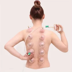 24-Piece Vacuum Cupping Set for Massage Therapy