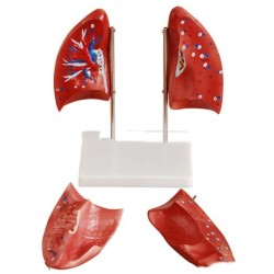 Lung Anatomical Model Lung Segment Model Respiratory System Model