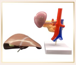 Medical Liver Planing Model Pancreas Spleen Duodenum Pancreas Structure Model