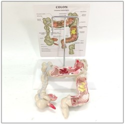 Medical Human Anatomical Intestine Model