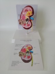 Anatomical Model Of Kidney Stone Pet Dog Lesion