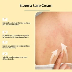 Bee Venom Eczema Care Cream - Soothing & Moisturizing Relief for All Skin Types